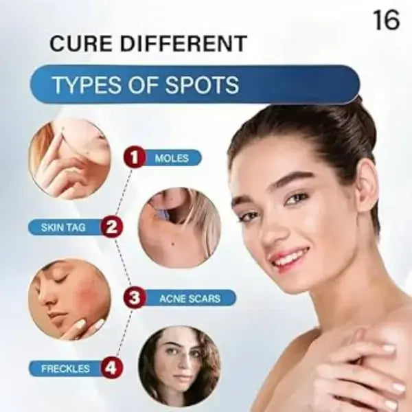 Timilk Wart & Mole Removal Spray