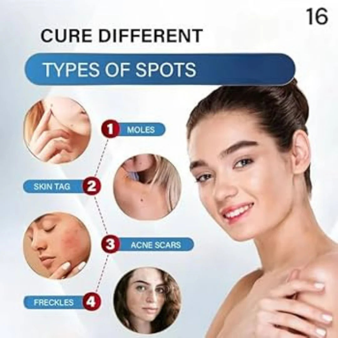 Timilk Wart & Mole Removal Spray