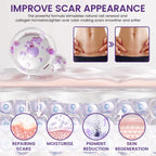 TiMilk ReGen Scar Stem Cell Repair Gel | Stretch Marks & Skin Repair Treatment (Imported)