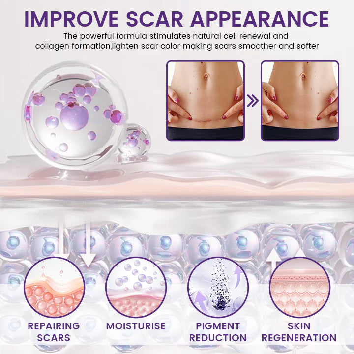 TiMilk ReGen Scar Stem Cell Repair Gel | Stretch Marks & Skin Repair Treatment (Imported)