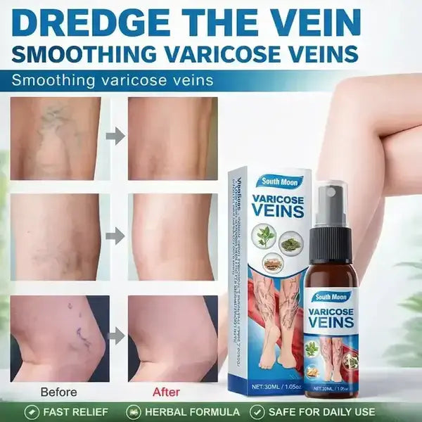Varicose Veins Treatment Spray - Veins Relief Oil