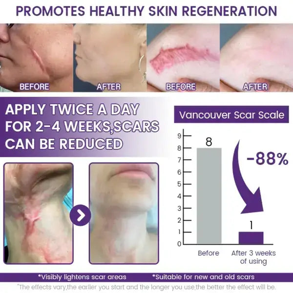 TiMilk ReGen Scar Stem Cell Repair Gel | Stretch Marks & Skin Repair Treatment (Imported)